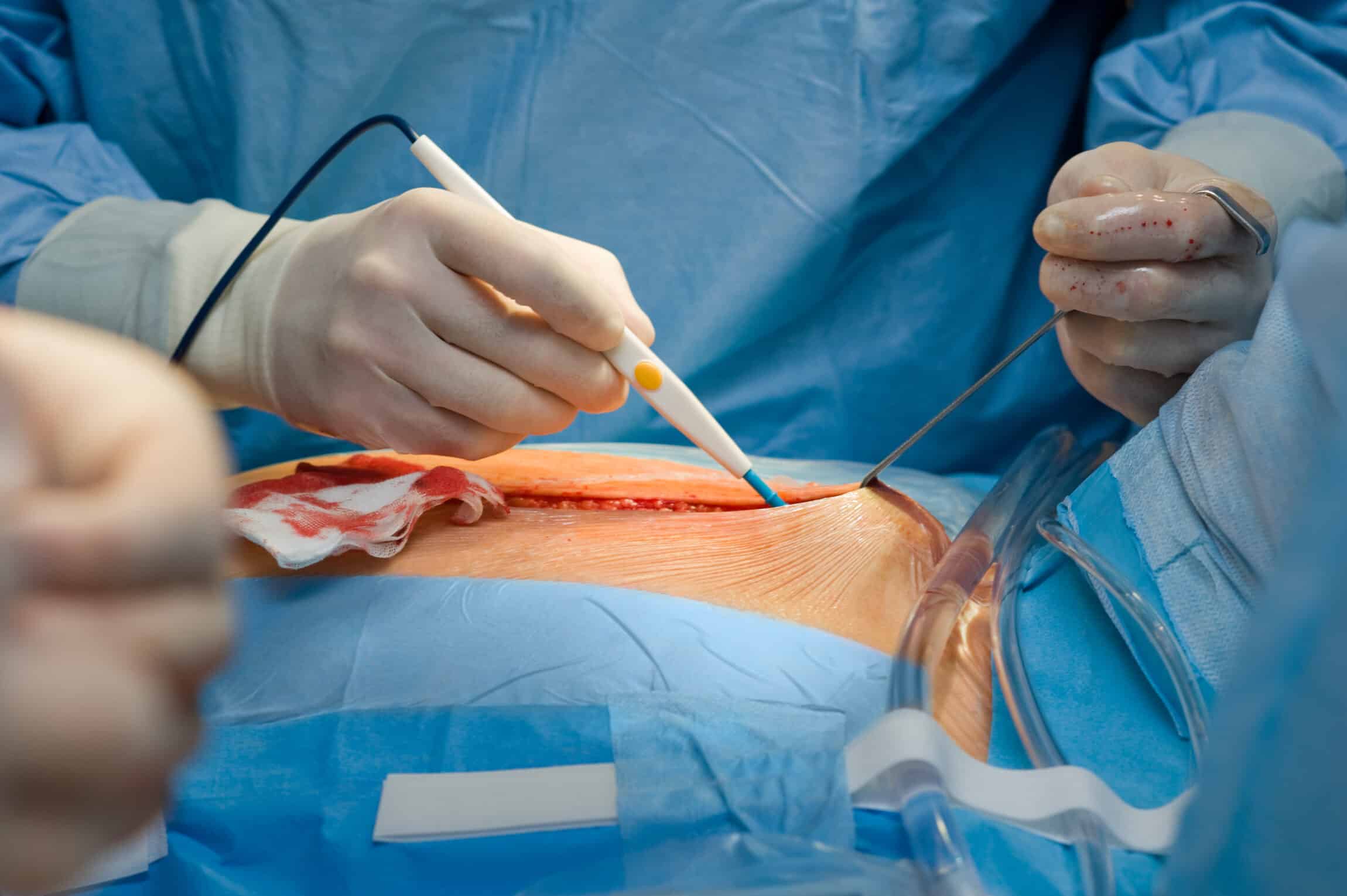 Chirurgie digestive