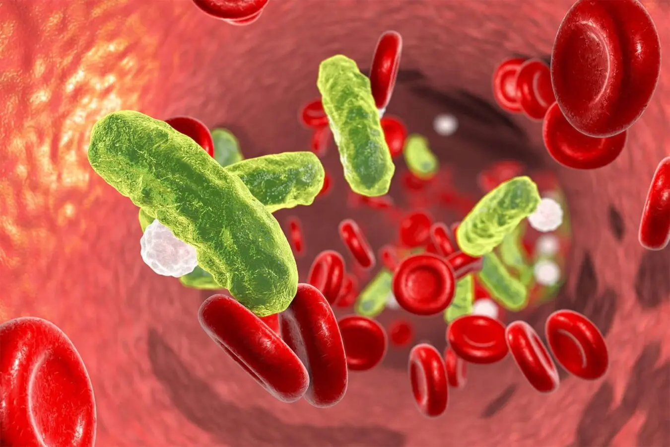 Chirurgie endocrinienne
